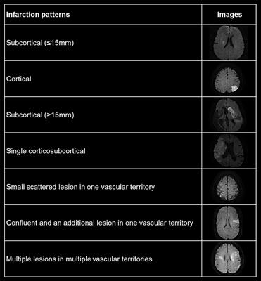 Characteristics and Factors for Short-Term Functional Outcome in Stroke Patients With Atrial Fibrillation, Nationwide Retrospective Cohort Study